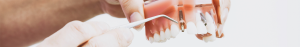 patient-info-ex-header-1