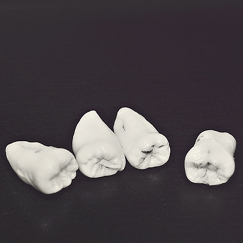 wisdomtooth2