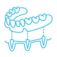 CVOS icons 2Teeth in a Day CVOS icons 2Teeth in a Day