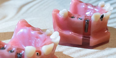 CVOS mobile header-1-2 teeth models