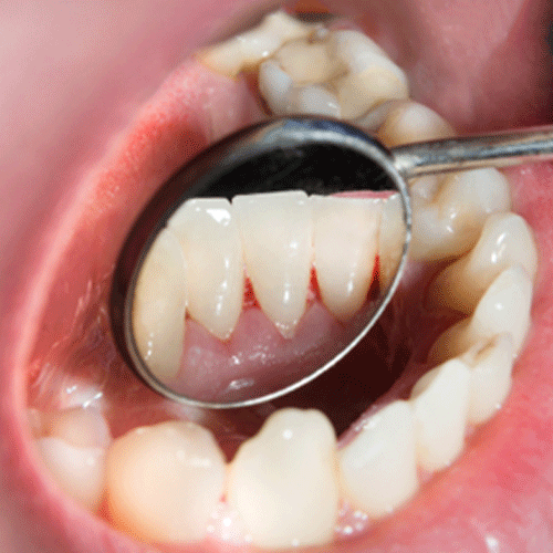 oraldisease_500x500